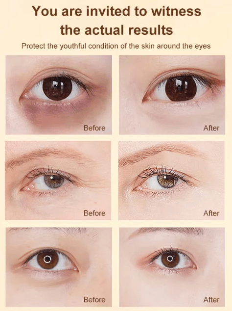 Dazzle Eye Oil | Nourishing Lutein Formula for Optimal Vision - Hartwella