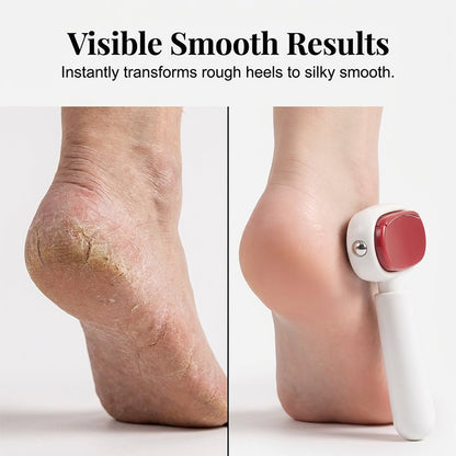 Dura Foot Scraper Tool | Dual - Sided Stainless Steel Callus Remover - Hartwella