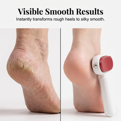 DuraSmooth Foot Scraper Tool | Stainless Steel Callus File Remover, Dual-Surface Design - Hartwella