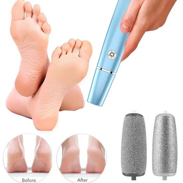 SilkStep Pro Foot Care Device | Electric Callus Remover, USB Rechargeable - Hartwella