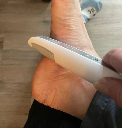 SilkStep Pro Foot Care Device | Electric Callus Remover, USB Rechargeable - Hartwella