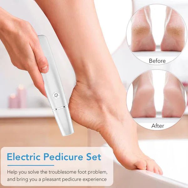SilkStep Pro Foot Care Device | Electric Callus Remover, USB Rechargeable - Hartwella